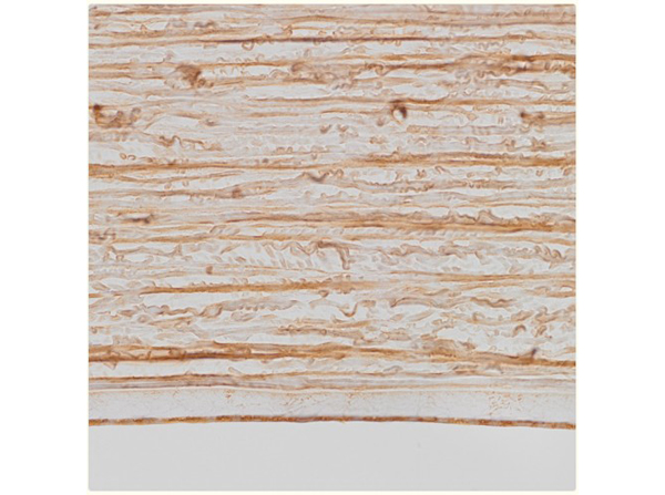 IHC using Anti-Cat IgG Fc